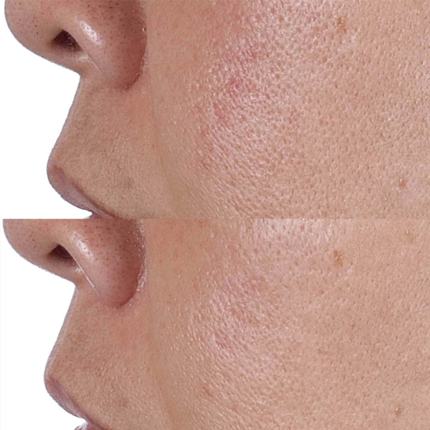 Тонік для обличчя з ефектом ліфтингу Perricone MD High Potency Face Finishing & Firming Toner