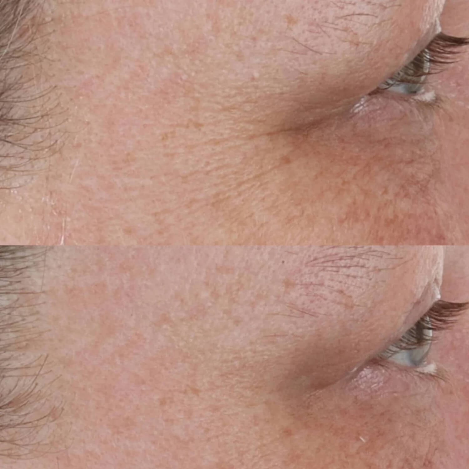 Зволожуючий нічний крем з ретинолом Perricone MD High Potency Retinol Recovery Overnight Moturizer