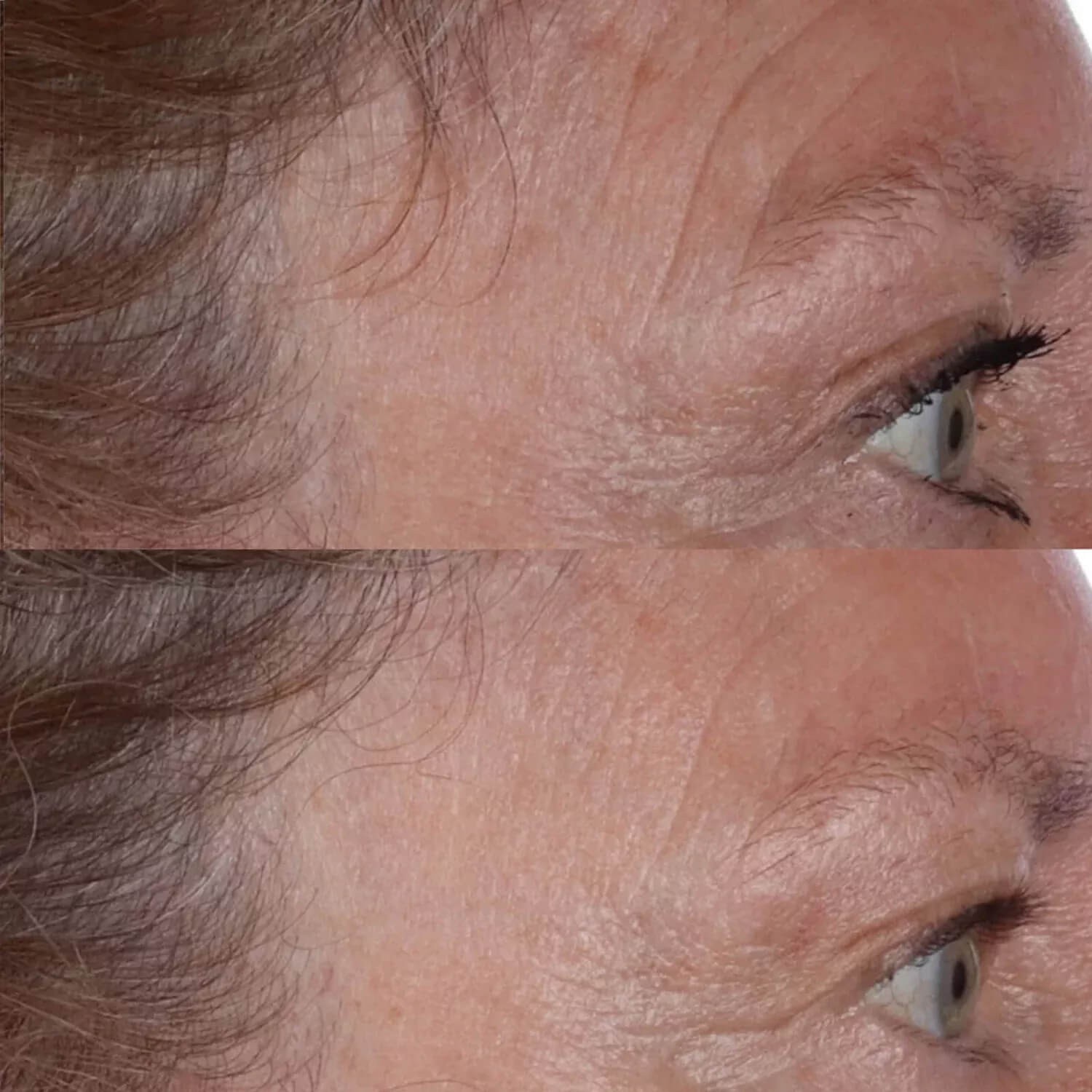 Эссенция для лица Perricone MD Cold Plasma Plus+ The Essence