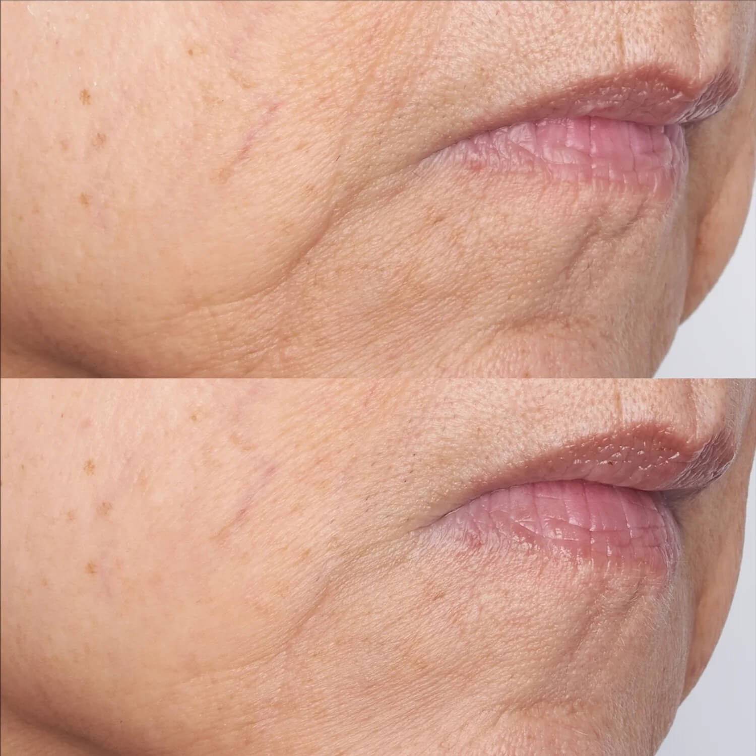Охолоджувальна гелева маска для обличчя Perricone MD Cold Plasma Plus+ The Intensive Gel Mask