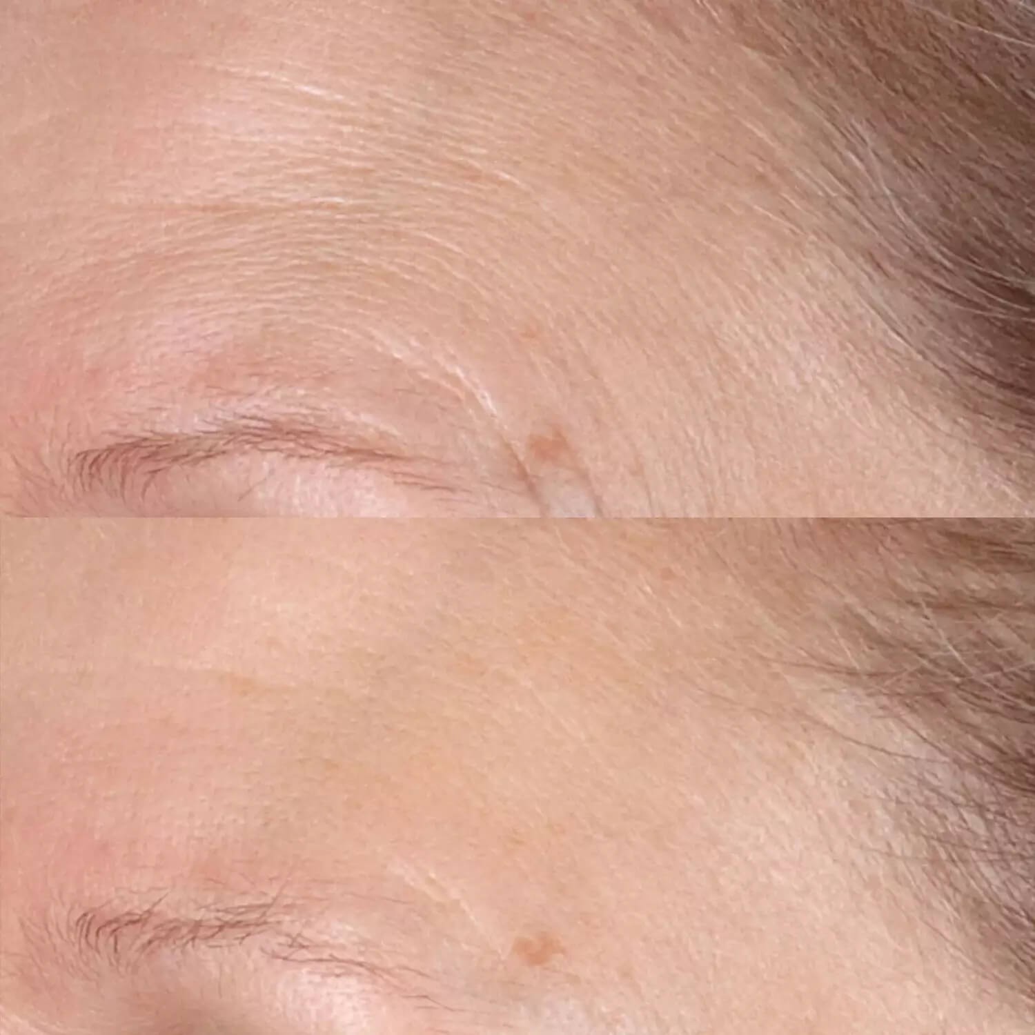Осветляющий пилинг с витамином С для повседневного использования  Perricone MD Vitamin C Ester Daily Brightening and Exfoliating Peel