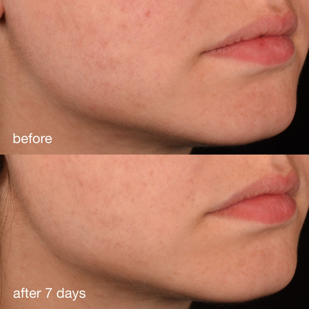 Антиоксидантная сыворотка с коллагеном Dermalogica Pro-Collagen Banking Serum