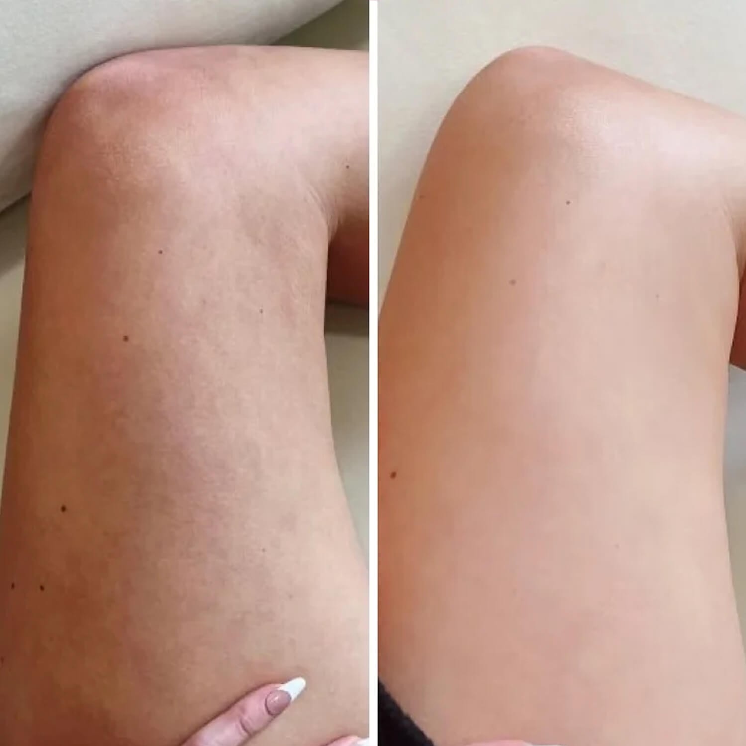 Антицелюлітний крем для проблемних зон Robeauty Me Hot Cream Anti-cellulite 