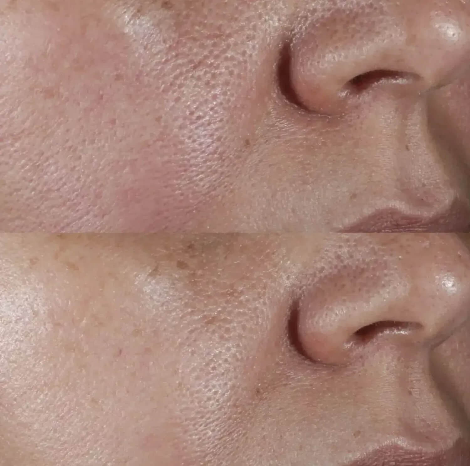 Тоник для очищения пор Perricone MD No:Rinse Intensive Pore