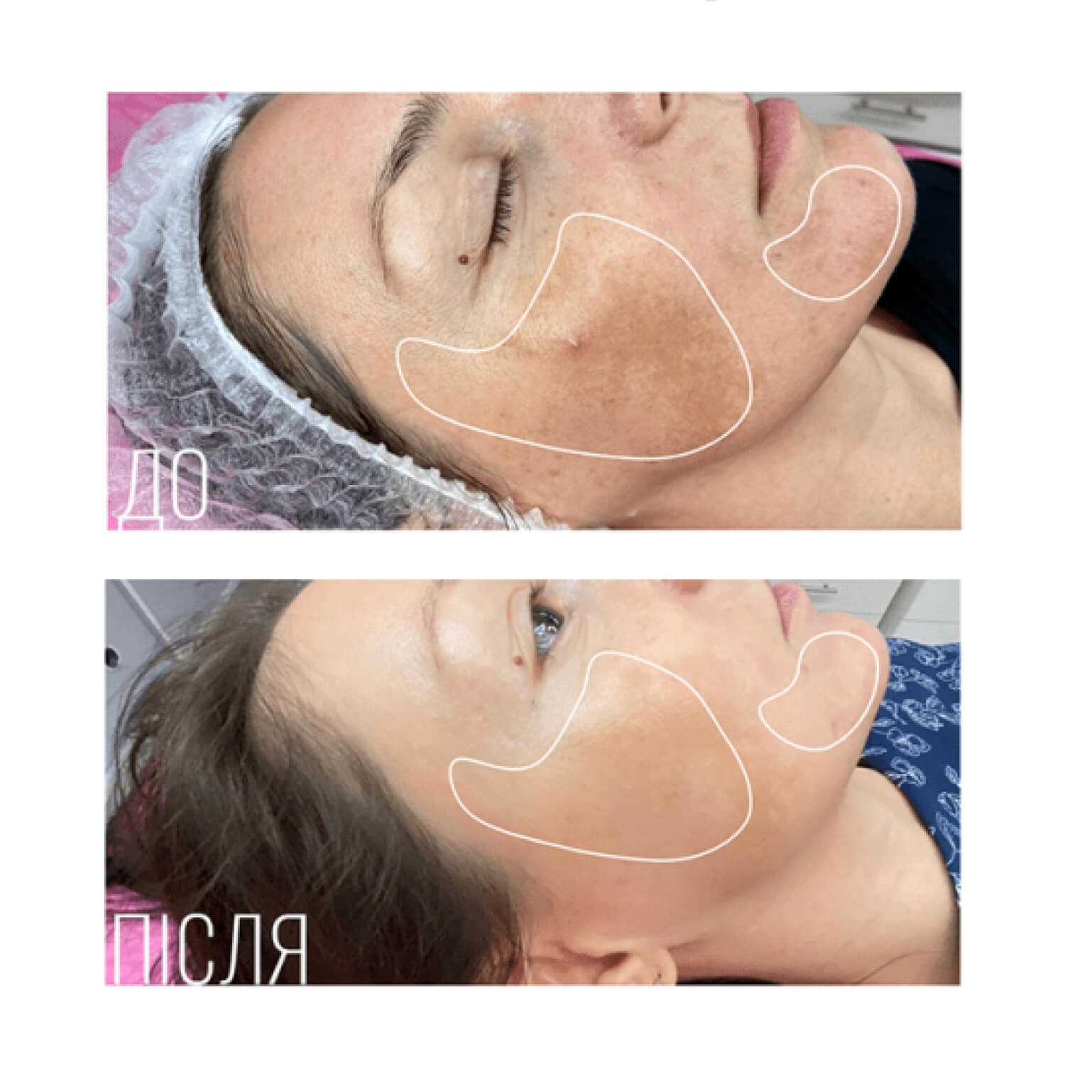 Тонер С Ретинолом Instytutum Advanced Retinol Toner