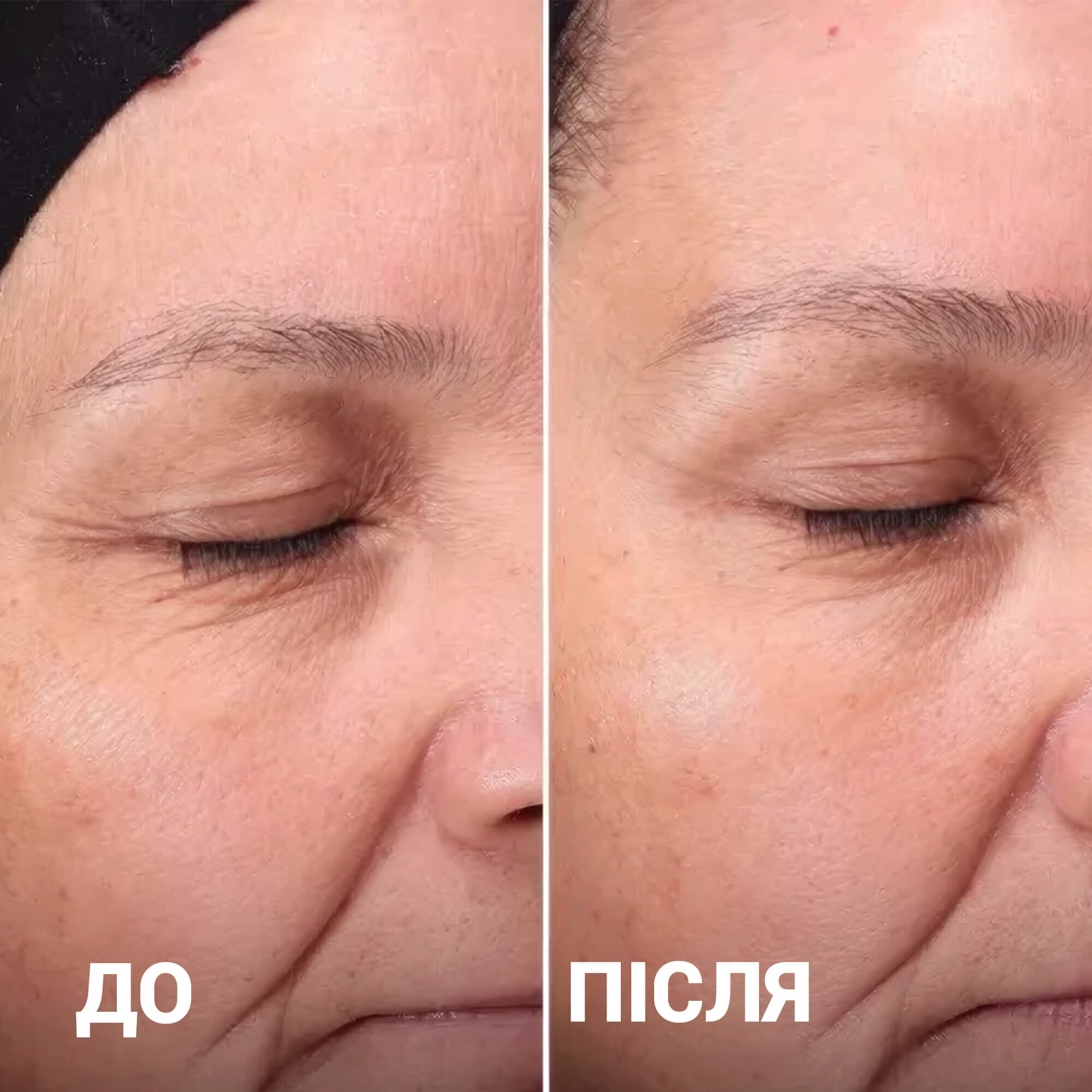Щоденний відлущуючий тонік із РНА змінний флакон Medik8 Press And Glow Refill