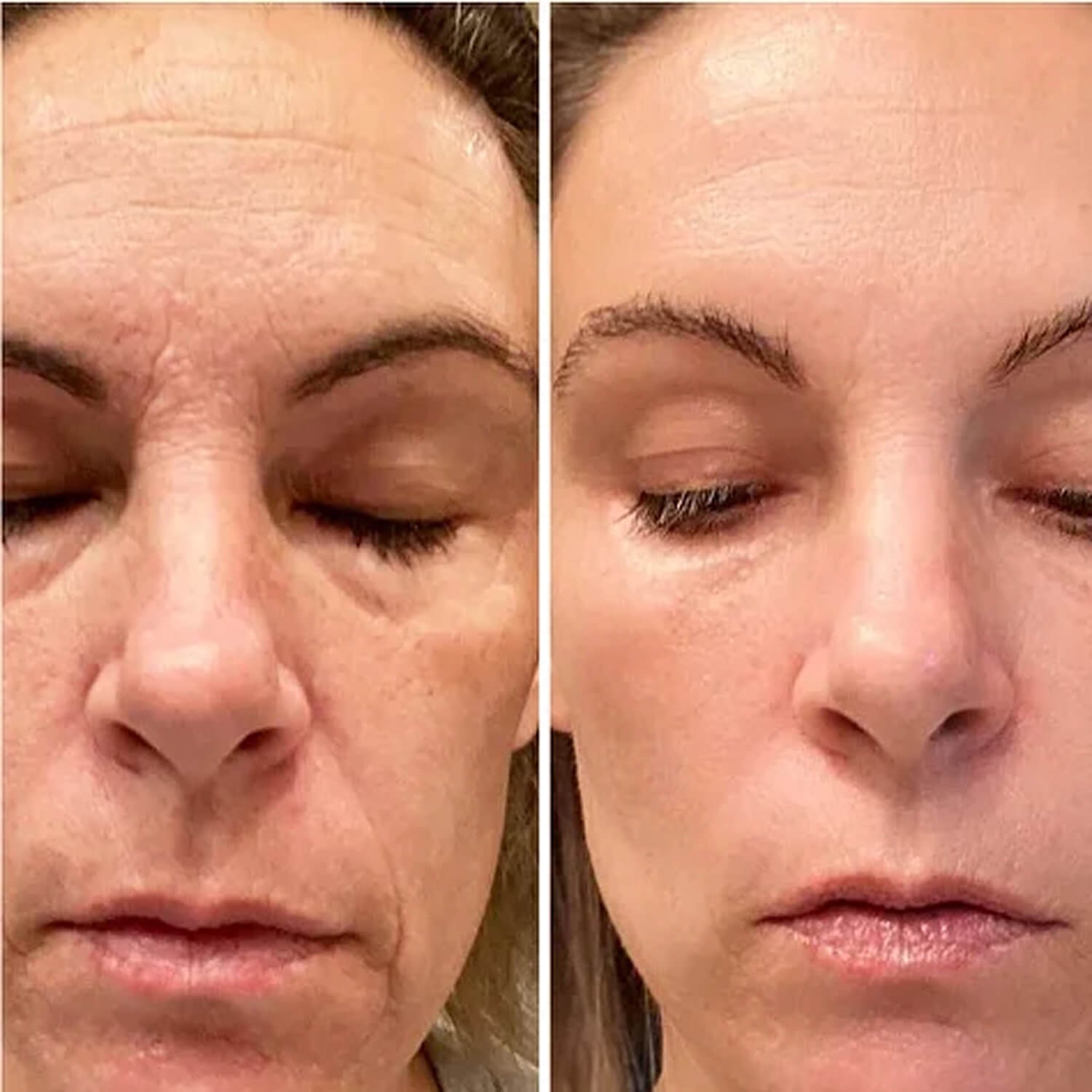 Освітлююча сироватка з бакучіолом проти зморшок Robeauty Me Bakuchiol and Sage CO2 Extract Serum for Wrinkles
