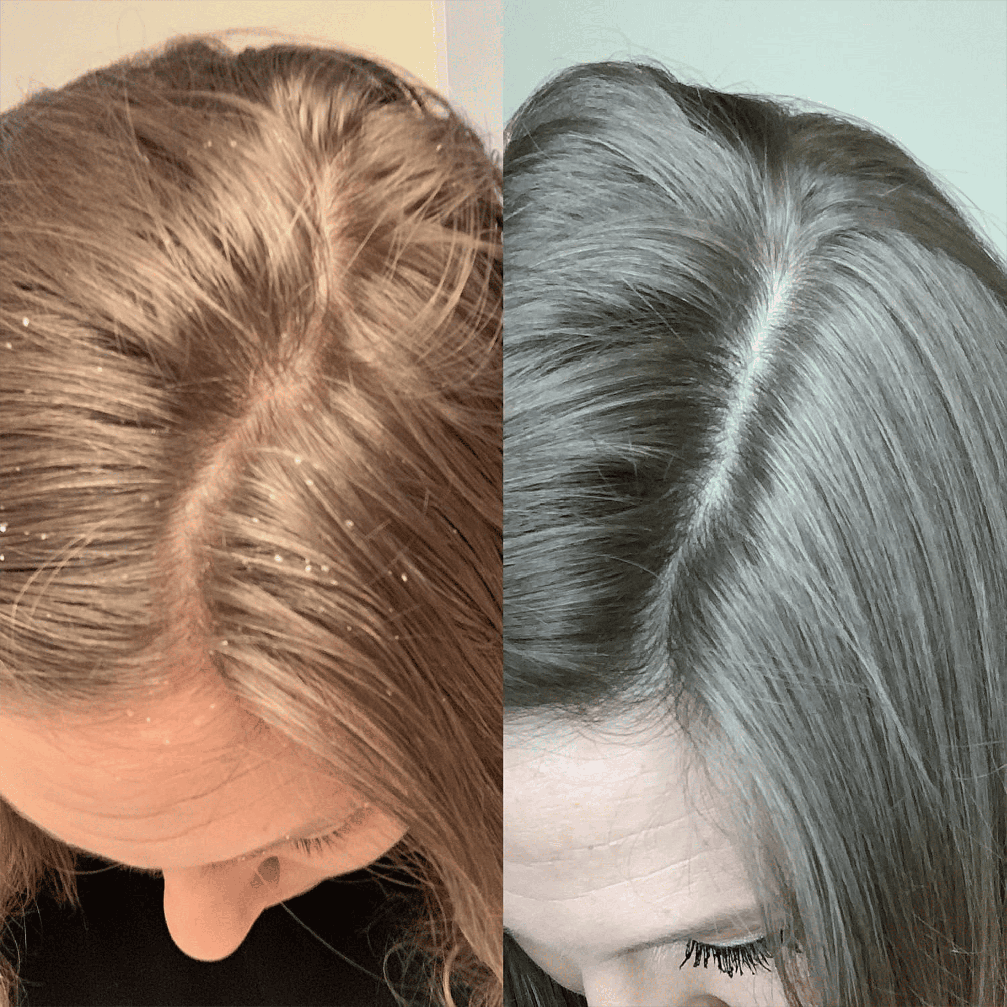 Средство для восстановления баланса кожи головы L’anza Healing Remedy Scalp Balancing Treatment