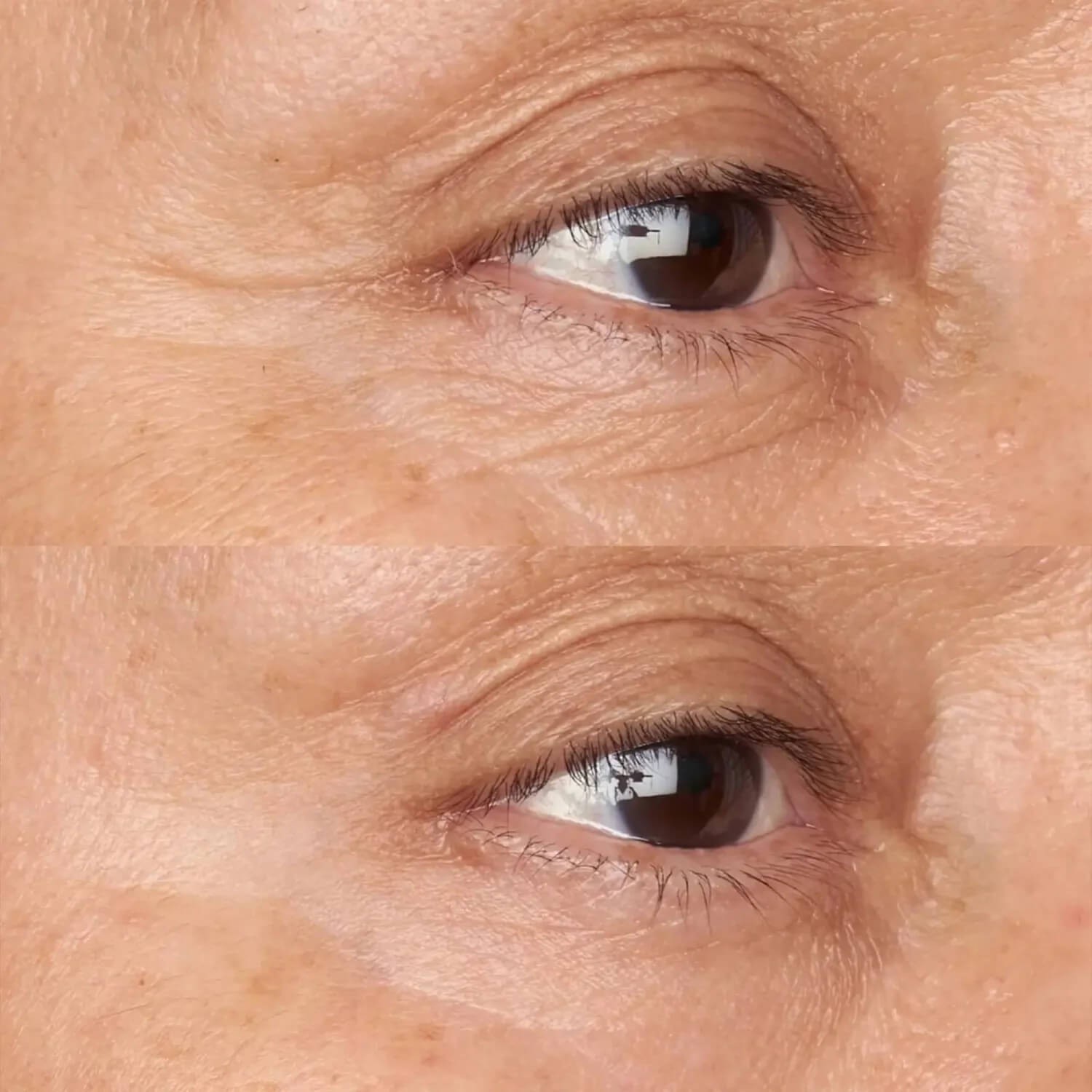 Заспокійливий засіб навколо очей для чутливої ​​шкіри Perricone MD Hypoallergenic Clean Correction Firming & Brightening Eye Cream