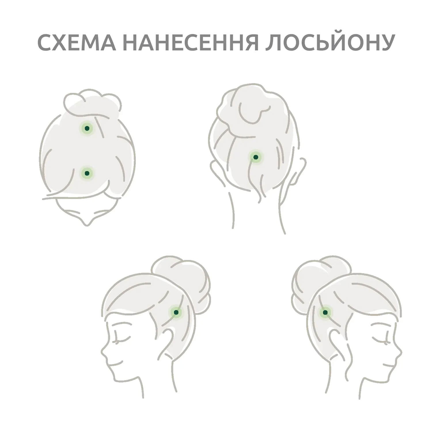 Ежедневный лосьон против андрогенетического выпадения волос Nubea Sursum Progressive Hairloss Daily Lotion