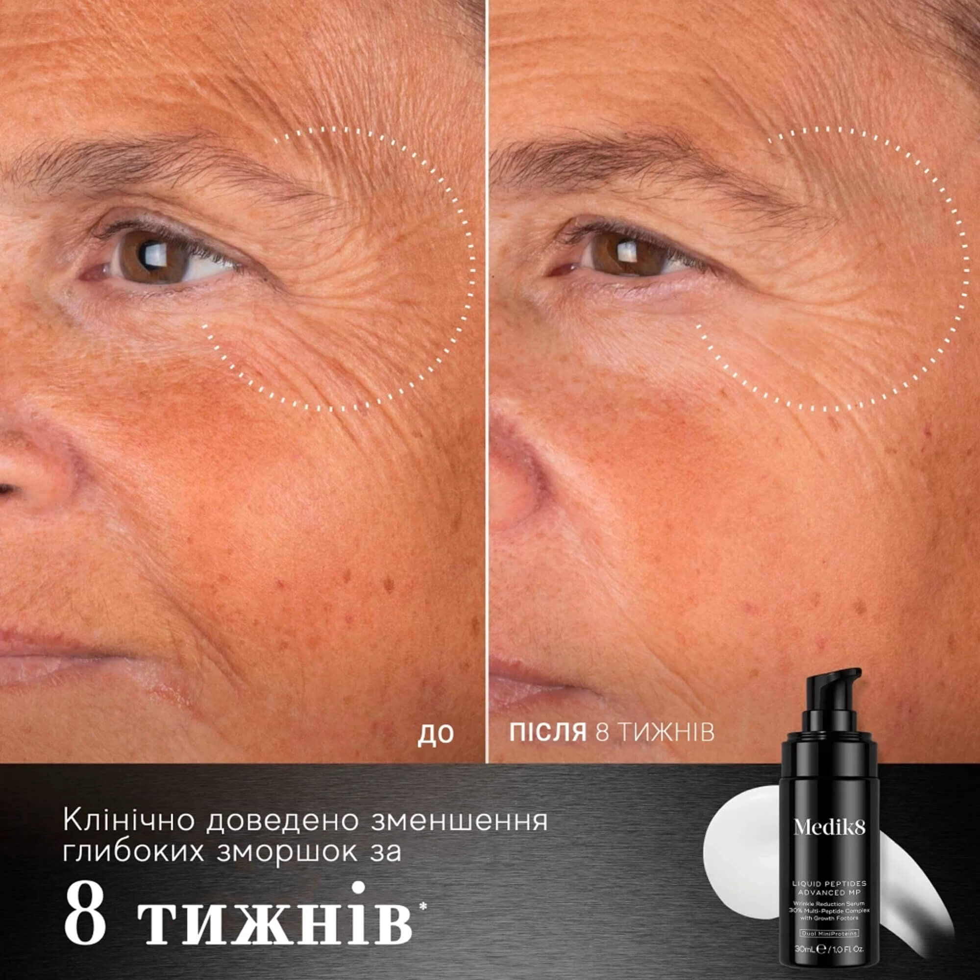 Инновационная сыворотка с технологией Dual MiniProteins Medik8 Liquid Peptides Advansed MP